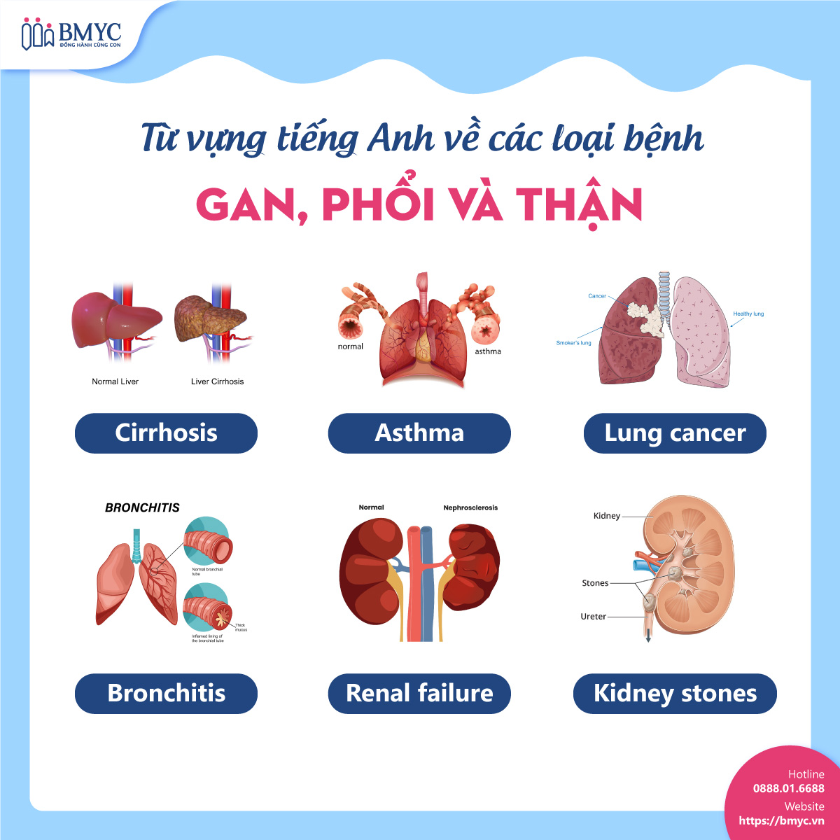 Từ vựng tiếng Anh về các loại bệnh gan, phổi và thận tong hop 99 tu vung cac loai benh.5 1