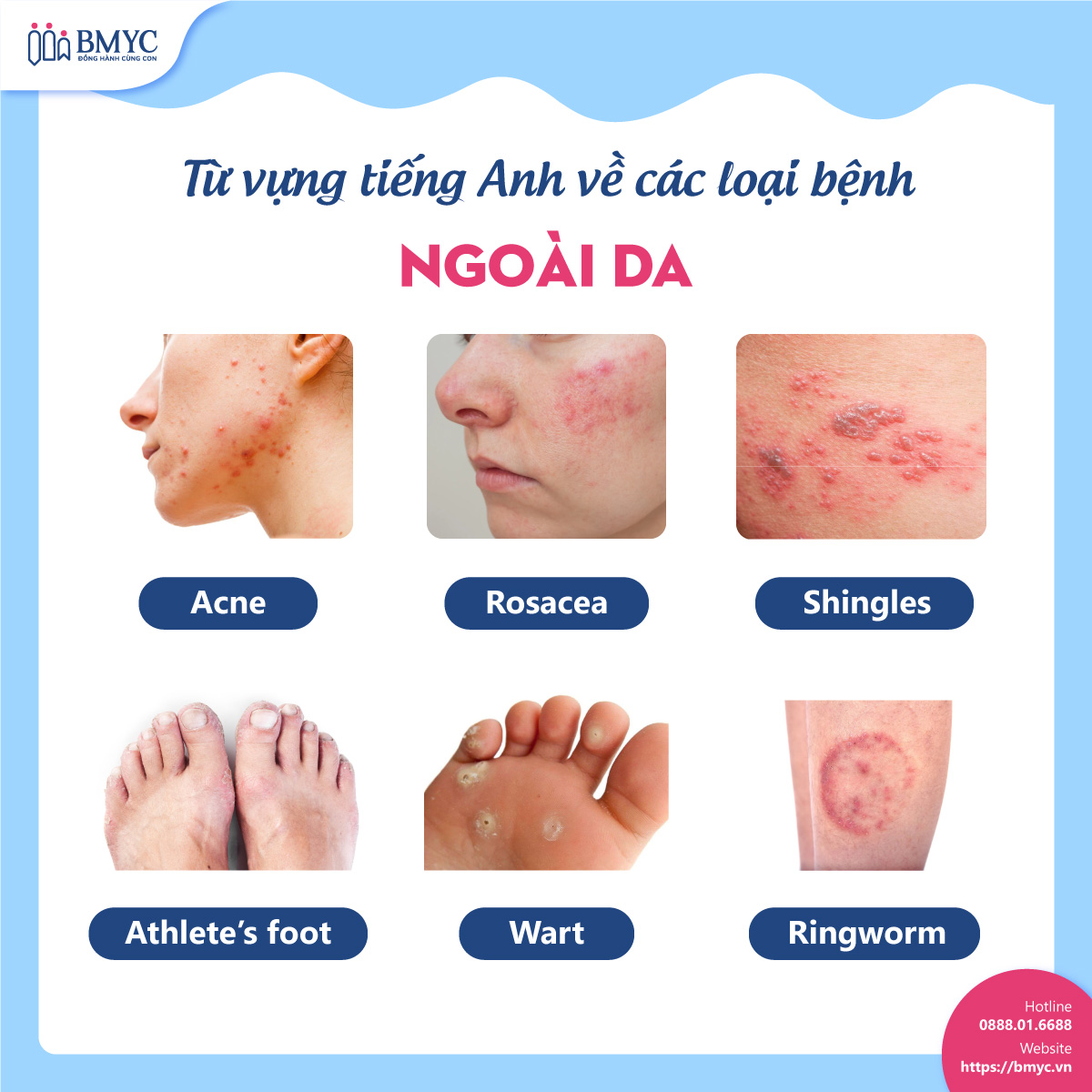 tong hop 99 tu vung cac loai benh.7